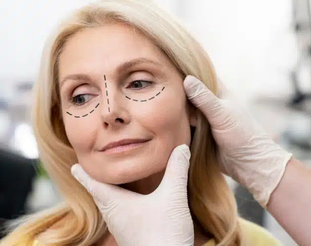 Blefaroplastia
