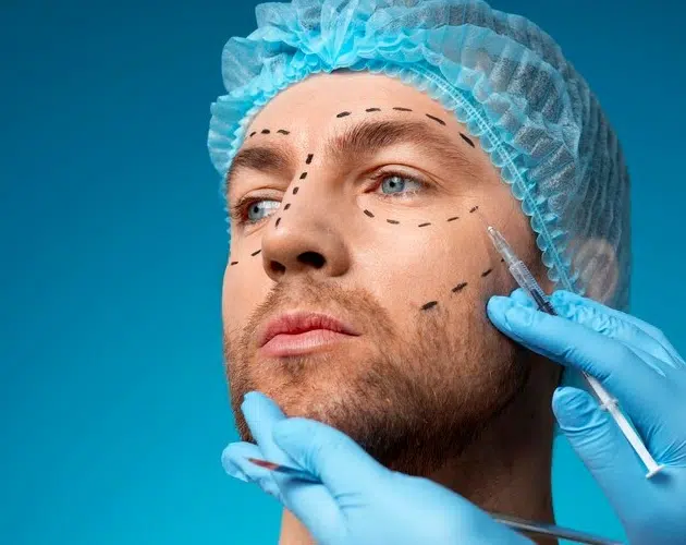 Cirugía Bichectomía