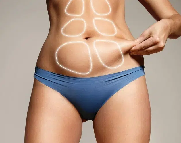 Lipomarcación Plástica